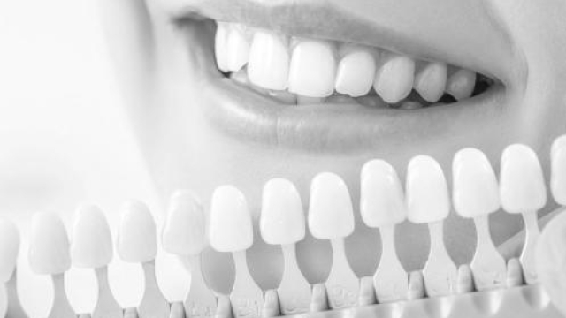 Sparkling Smiles: 5 Effective Teeth Whitening Methods